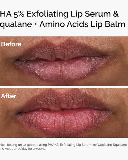 The Ordinary 
PHA 5% Exfoliating Lip Serum