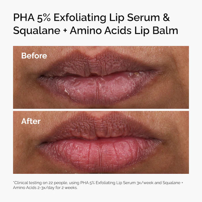 The Ordinary 
PHA 5% Exfoliating Lip Serum