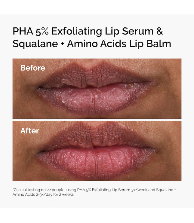 The Ordinary 
PHA 5% Exfoliating Lip Serum