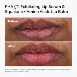 The Ordinary 
PHA 5% Exfoliating Lip Serum