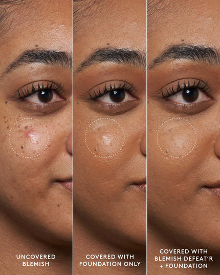 FENTY BEAUTY - BLEMISH DEFEAT'R BHA SPOT-TARGETING GEL