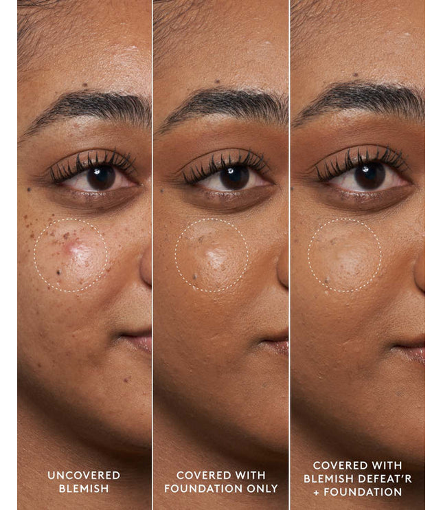 FENTY BEAUTY - BLEMISH DEFEAT'R BHA SPOT-TARGETING GEL