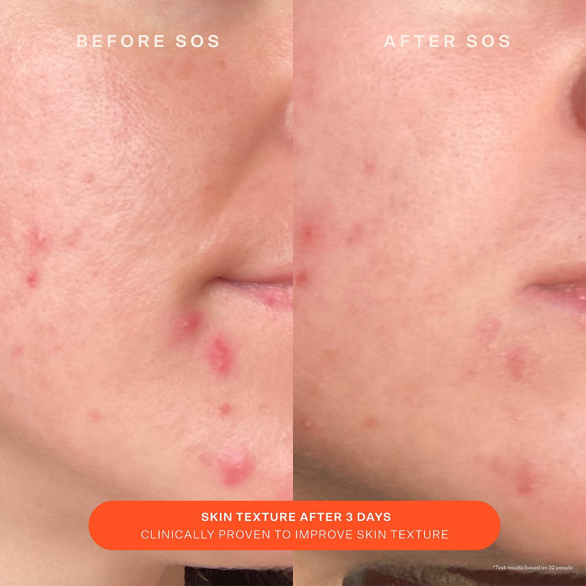 Tower 28 - SOS Daily Skin Barrier Redness Recovery Moisturizer