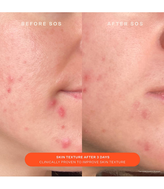 Tower 28 - SOS Daily Skin Barrier Redness Recovery Moisturizer