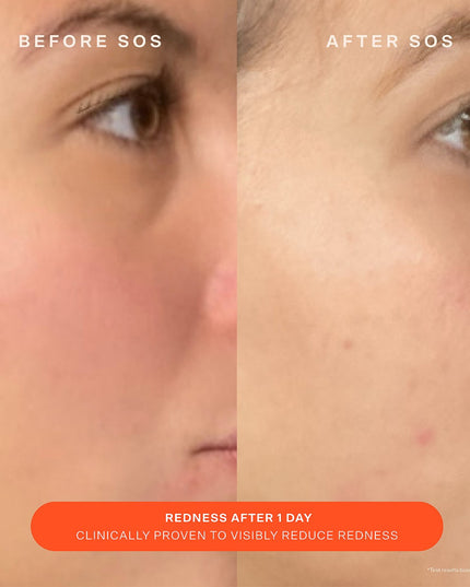 Tower 28 - SOS Daily Skin Barrier Redness Recovery Moisturizer