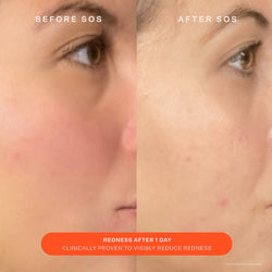 Tower 28 - SOS Daily Skin Barrier Redness Recovery Moisturizer