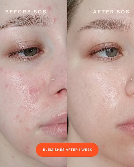 Tower 28 - SOS Intensive Redness Relief Serum