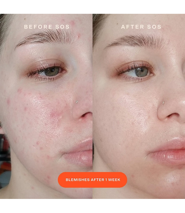 Tower 28 - SOS Intensive Redness Relief Serum