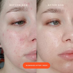 Tower 28 - SOS Intensive Redness Relief Serum