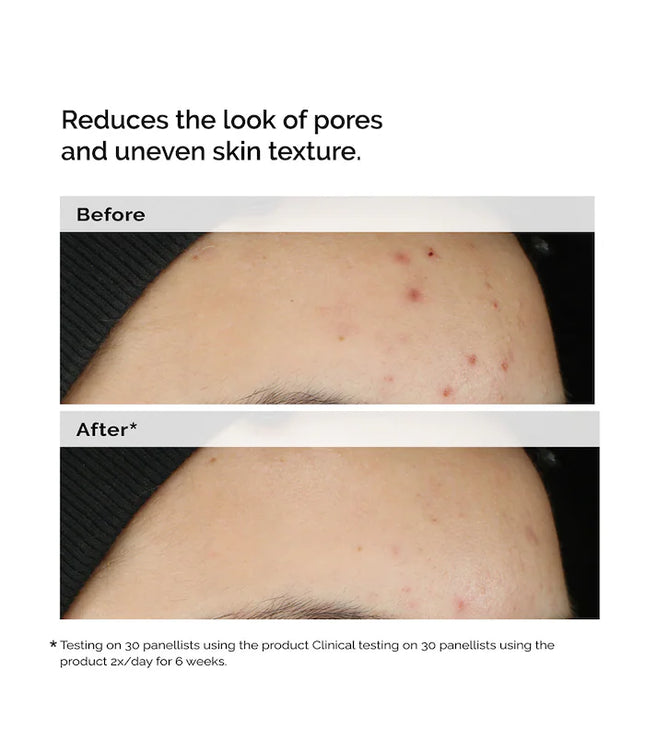 The Ordinary 
Balancing & Clarifying Serum for Blemish-Prone Skin