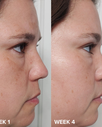 Paula's Choice - Skin Perfecting 2% BHA Liquid Exfoliant 30 ml travel size