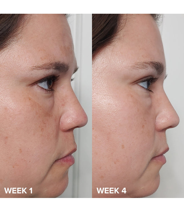 Paula's Choice - Skin Perfecting 2% BHA Liquid Exfoliant 30 ml travel size