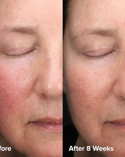 Paula's Choice - Skin Perfecting 6% Mandelic Acid + 2% Lactic Acid Liquid Exfoliant