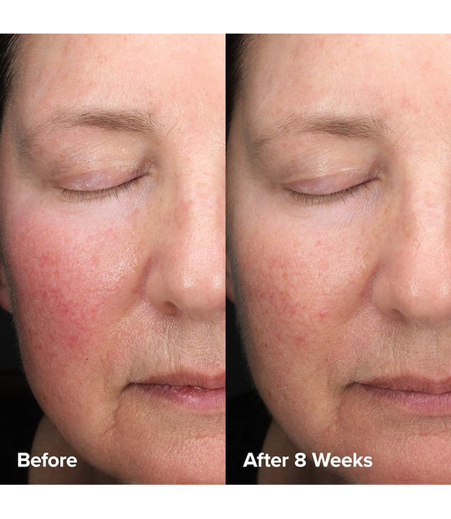 Paula's Choice - Skin Perfecting 6% Mandelic Acid + 2% Lactic Acid Liquid Exfoliant