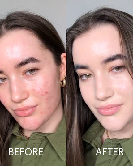 Dr. Jart+ -Cicapair™ Tiger Grass Color Correcting Treatment