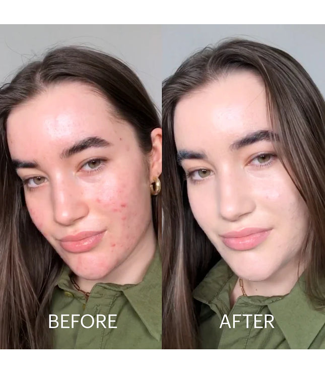 Dr. Jart+ -Cicapair™ Tiger Grass Color Correcting Treatment