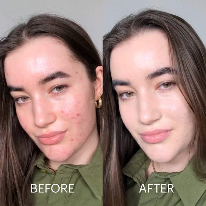 Dr. Jart+ -Cicapair™ Tiger Grass Color Correcting Treatment