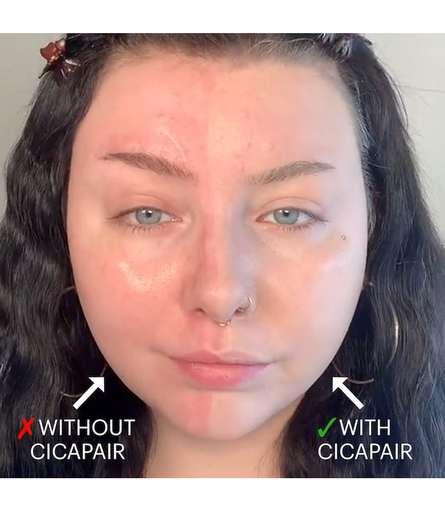 Dr. Jart+ -Cicapair™ Tiger Grass Color Correcting Treatment