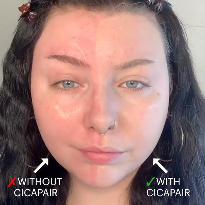 Dr. Jart+ -Cicapair™ Tiger Grass Color Correcting Treatment