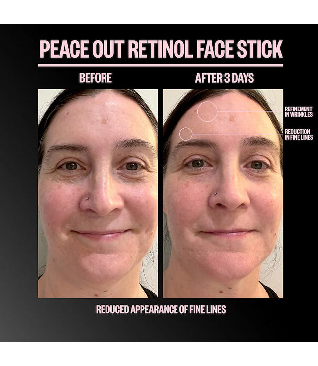 Peace Out - Retinol Face Stick