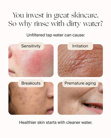 CANOPY The Canopy Faucet Filter for Healthy Skin