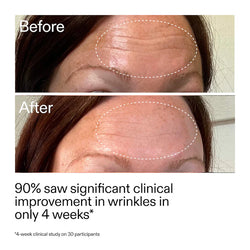 The INKEY List - Starter Retinol Serum for Fine lines + Wrinkles