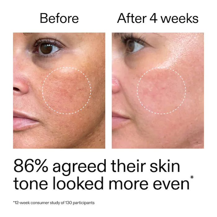 The INKEY List - Starter Retinol Serum for Fine lines + Wrinkles