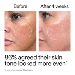 The INKEY List - Starter Retinol Serum for Fine lines + Wrinkles