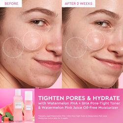 Glow Recipe - Watermelon Pink Juice Oil-Free Refillable Moisturizer