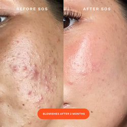 Tower 28 - SOS Daily Rescue Facial Spray